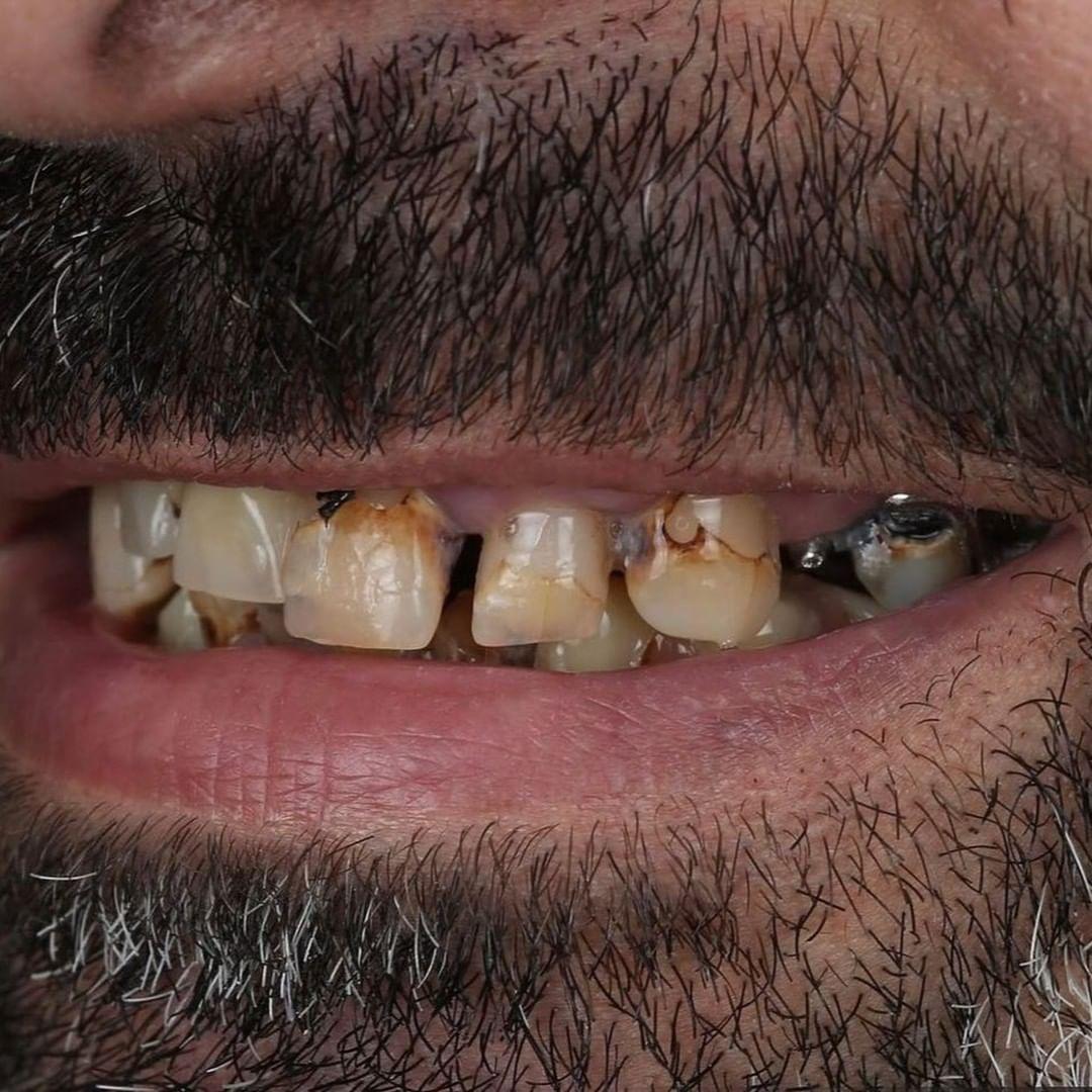 facingturkije-redent-1.jpg facingturkije-redent-1.jpg